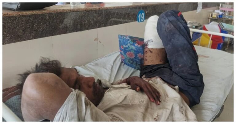 Leg of worker permanently paralyzed due to police negligence rescued after 12 hours